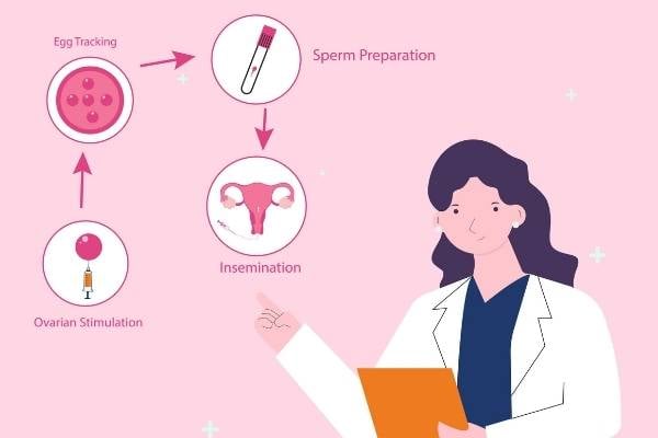 iui intrauterine insemination fertility treatment diagram