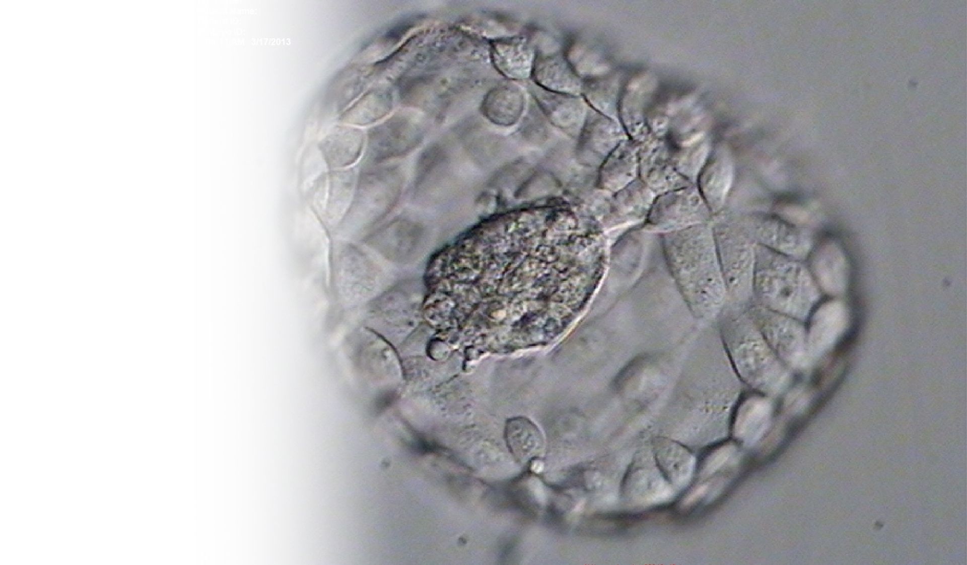 ivf embryo genetic testing