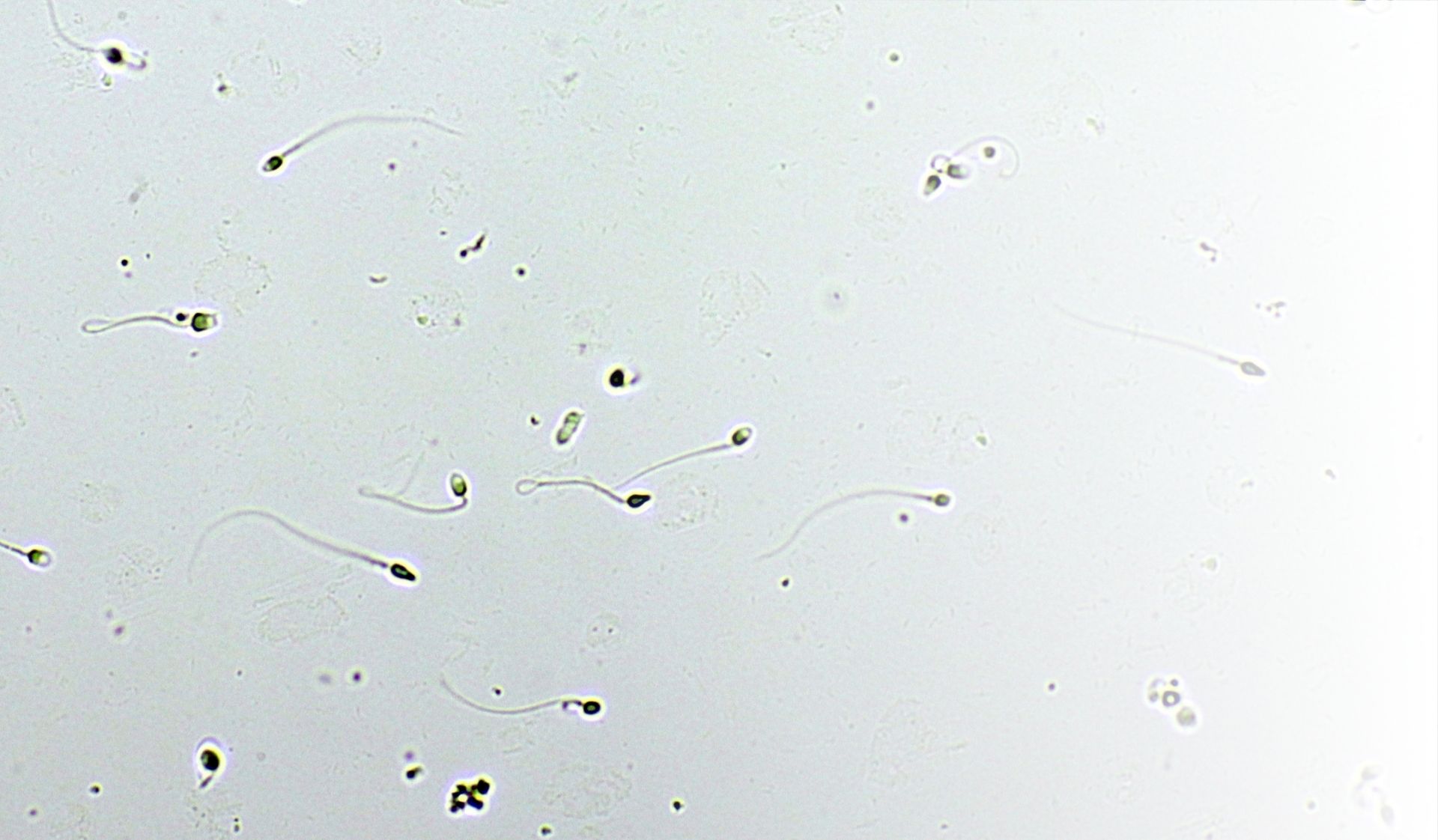 male fertility testing semen analysis infertiltiy