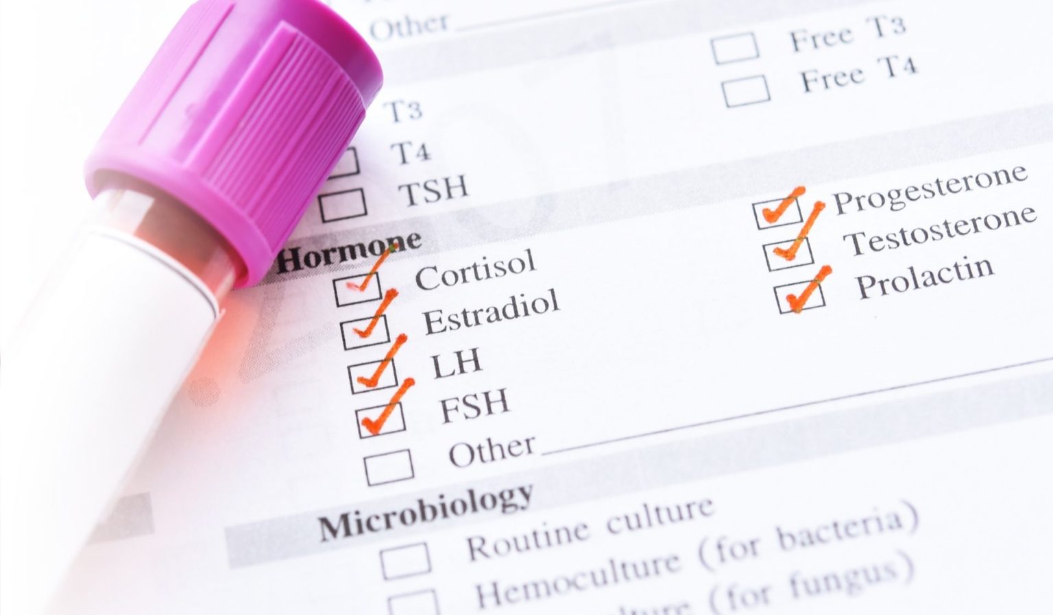 Infertility Testing Complete Fertility Tests for Women & Men