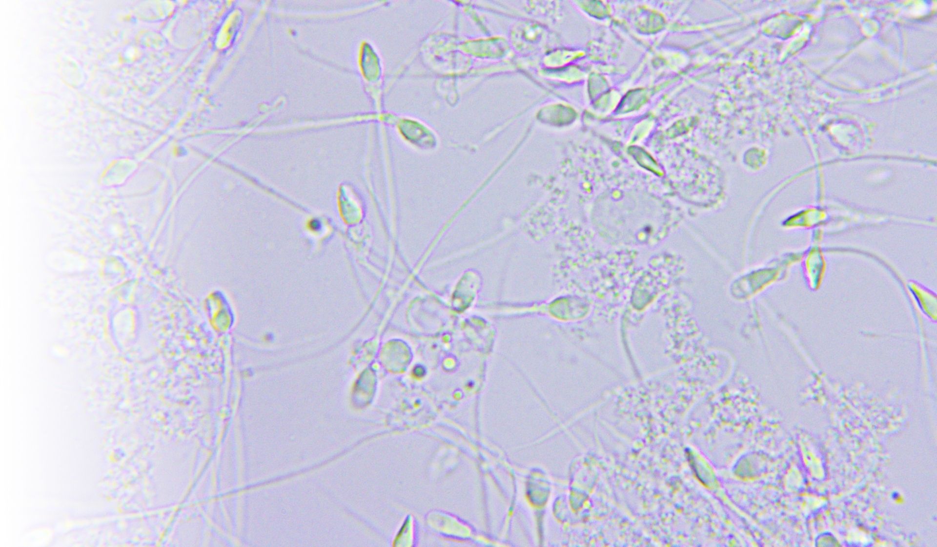 Infertility Testing Rma Network Fertility Clinic Complete