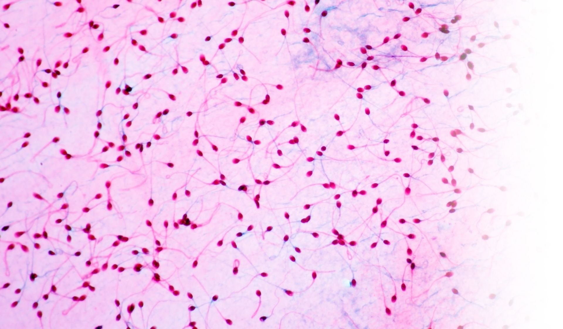 semen analysis test sperm evaluation