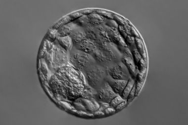 blastocyst embryo ivf