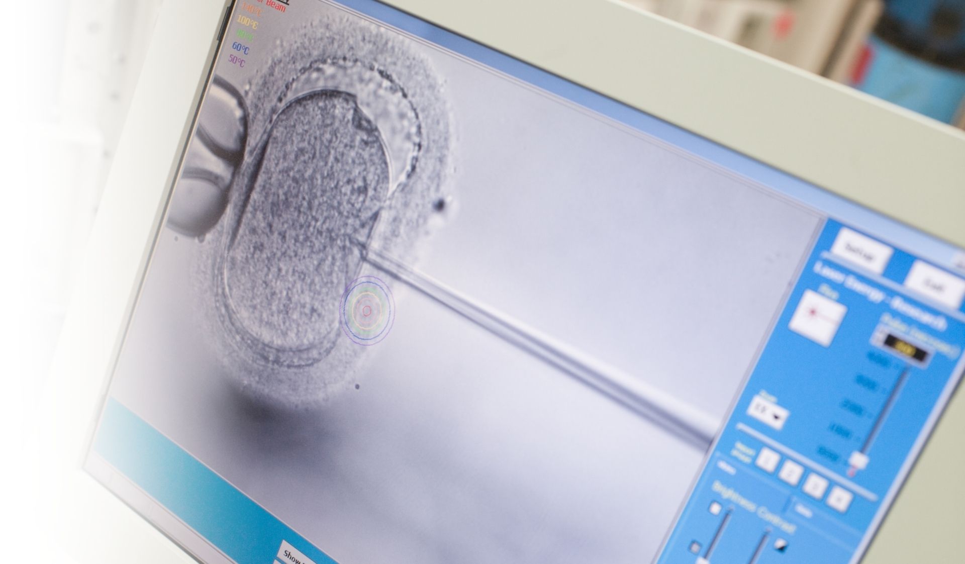 ivf procedure icsi