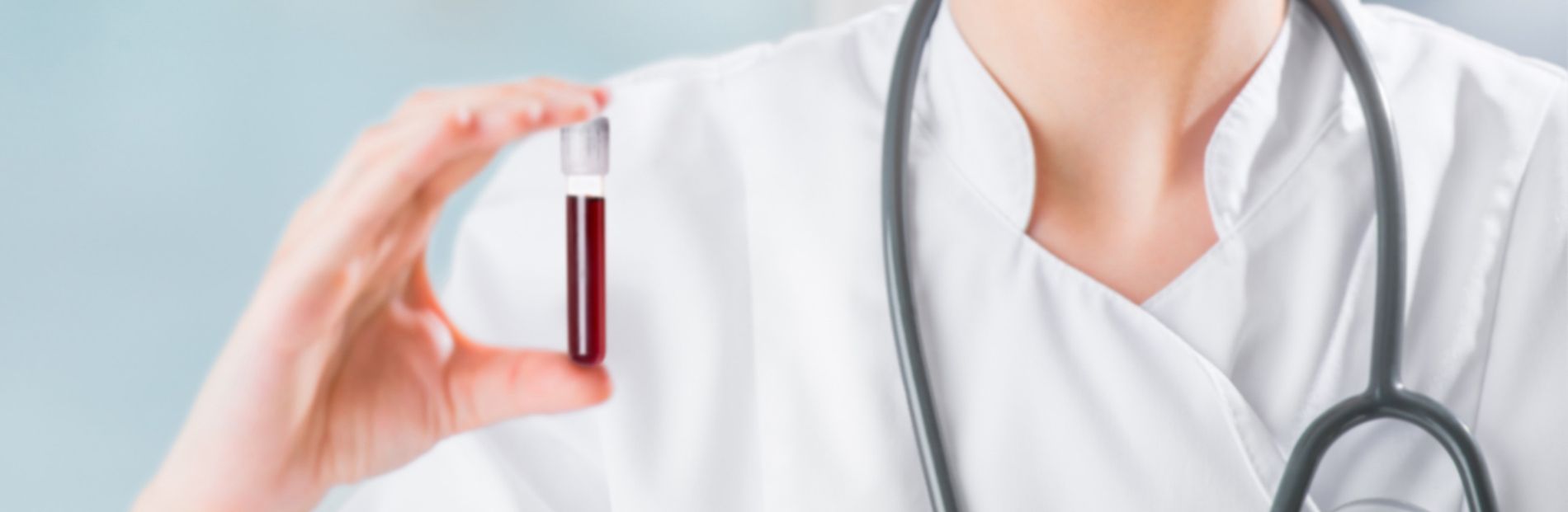 amh fsh blood test