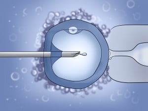 Perform-an-Intracytoplasmic-Sperm-Injection-(Icsi)-Step-8