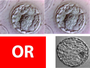 A visual example of performing a single embryo transfer vs a double embryo transfer in IVF