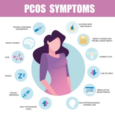 pcos symptoms and signs