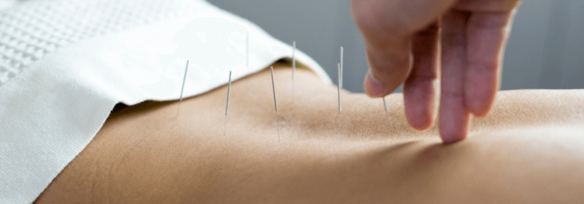 Acupuncture as a form of treatment for infertility