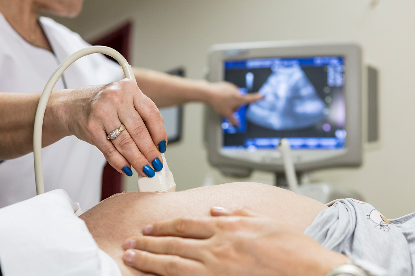 Pregnancy ultrasound symbolizing Philadelphia IVF success rates